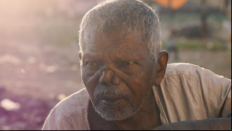 Fotografía: pxhere Retrato hombre con lepra