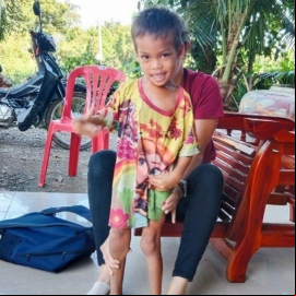 Personal de Karuna Battambang ayuda a Chetra a Caminar. Foto: Manos Unidas/Karuna Battambang